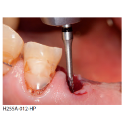 H255A-012-FGXXL-fraise-dentaire