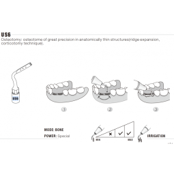 Insert US6 Piezo - DTE Woodpecker