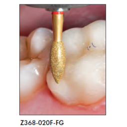 Z368-020C-FG-fraise-dentaire