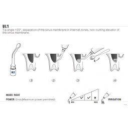 Insert UL1 Piezo - DTE Woodpecker