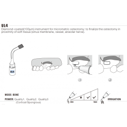 Insert UL4 Piezo - DTE Woodpecker