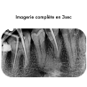 Capteur radio iSensor H1 RVG X-ray - Woodpecker